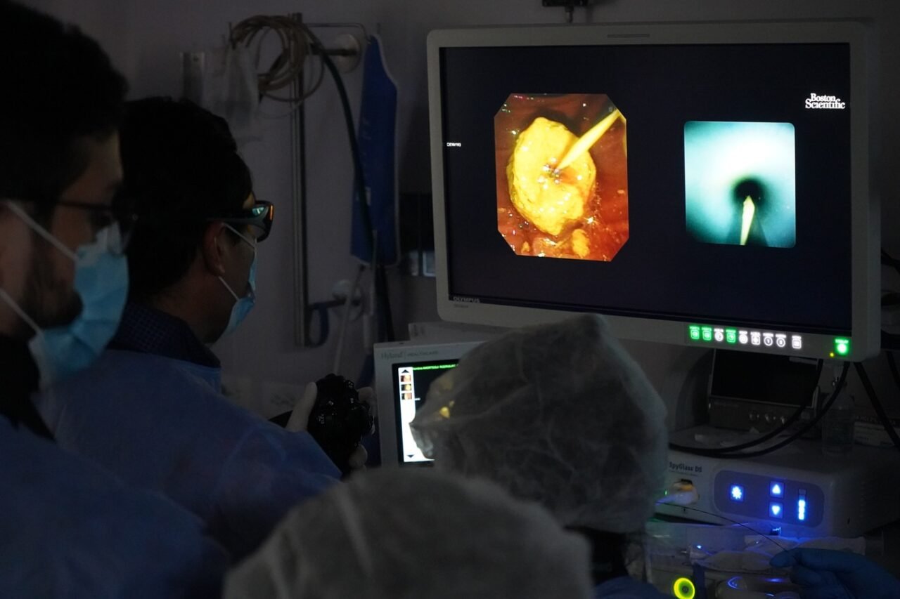 Colombia realiza primera ablación en la vía biliar con catéter Habib por radiofrecuencia