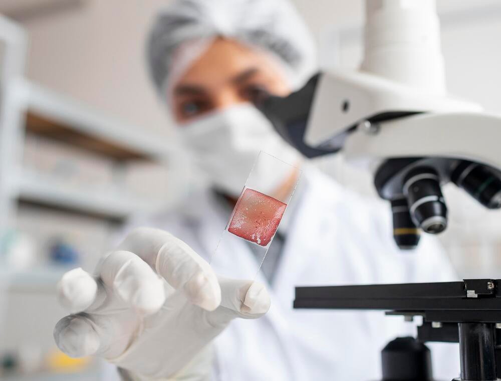10% de la población tiene alguna patología tiroidea: ¿existe alguna relación entre el hipotiroidismo y la salud mental?