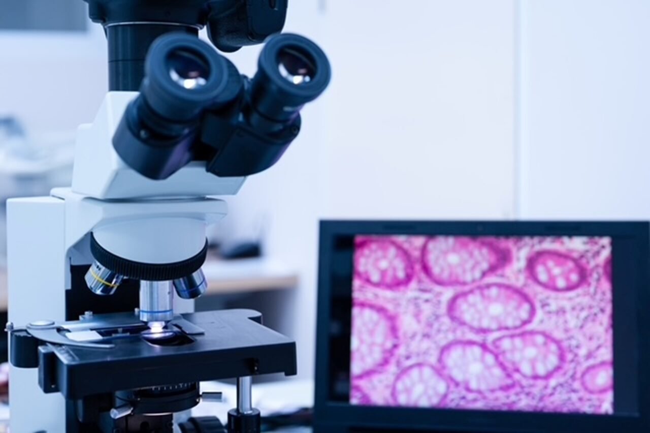 Implementan en Colombia el primer modelo de Patología 100% Digital