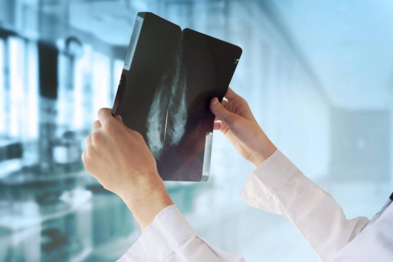 Desarrollan tecnología innovadora para detectar precozmente tumores de seno